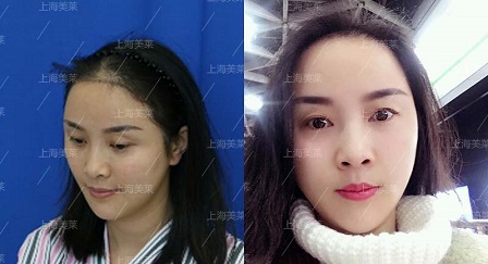 熊秋萍