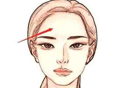 眉间纹去除术要多少钱