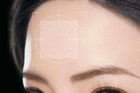 去抬头纹手术需要多少钱