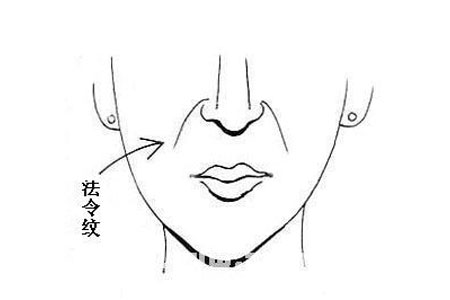 嘴角纹很深要怎么去除啊