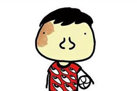 胎记真的可以通过激光的方式去除吗