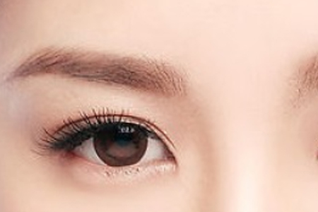 做韩式三点双眼皮手术安全吗