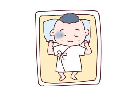 身上有胎记什么方法可以去除