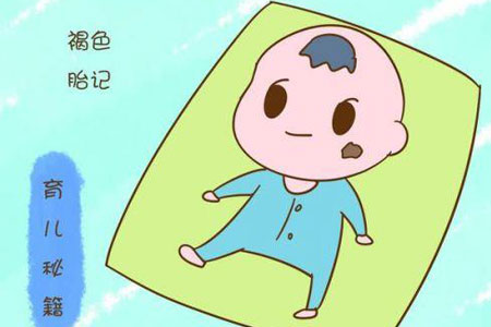 脸上的胎记如何才能去掉