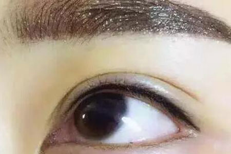 做美瞳线价格一般是多少钱