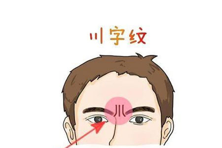 注射玻尿酸去除川字纹需要多少钱