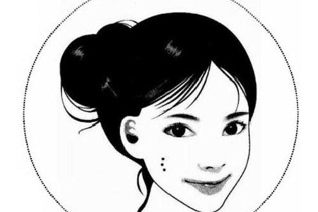 激光去痣治疗大概是多少钱