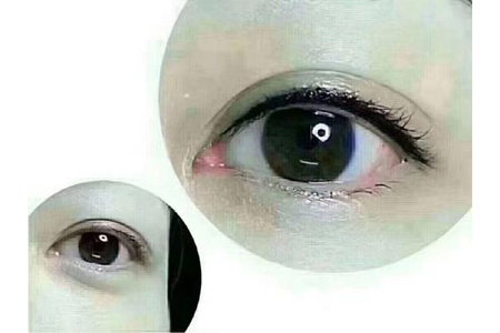 纹个美瞳线大概是需要多少钱