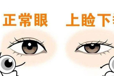 眼睛一个大一个小什么方法才能改善啊