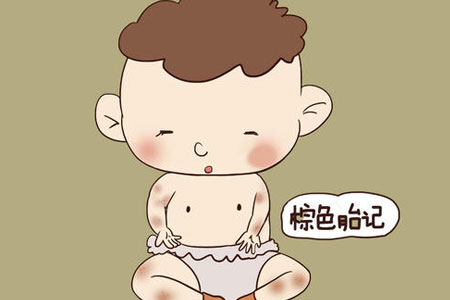 脸上有一个小胎记怎么去除啊