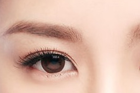 上海美莱做双眼皮自然吗