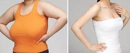 上海乳形矫正手术多少钱