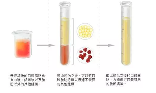 川字纹怎么消除