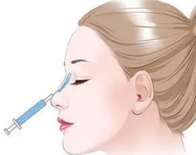 注射隆鼻能维持多久