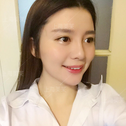 ANNAN
