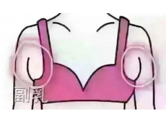 副乳的较好切除时间