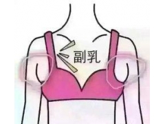 女性副乳有哪些危害