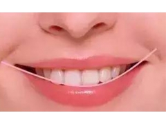 上海美莱张国栋为大家介绍牙齿矫正的八大好处