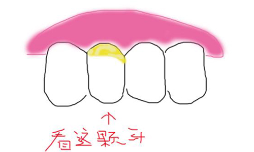 牙周病是什么原因导致的，怎么治疗