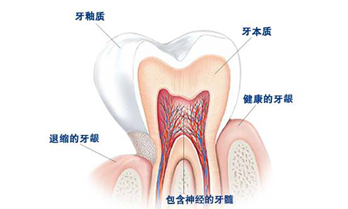 牙周病是什么原因导致的，怎么治疗