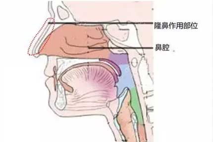 有鼻炎能做隆鼻吗