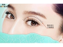 上海韩式双眼皮价格一般为多少