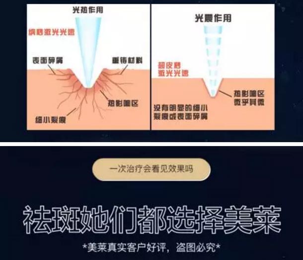上海美莱整形|超皮秒特价限时抢购