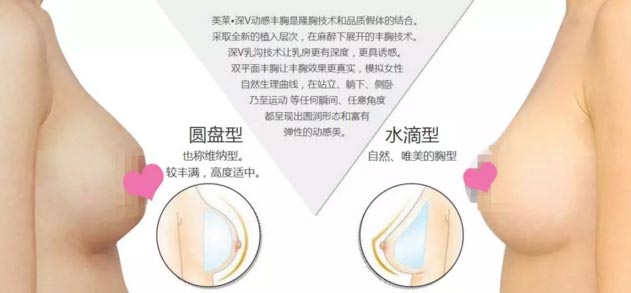 上海美莱医院隆胸效果怎么样