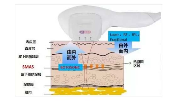 上海美莱超声逆龄提拉"治"将逝去的青春