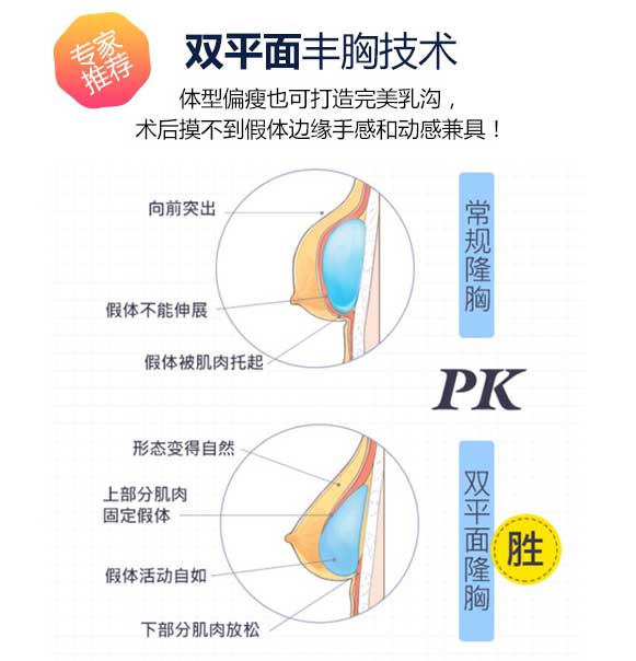 假体隆胸上海那个医院做好