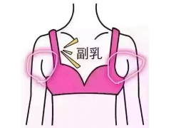 请问副乳越来越大应该怎么办