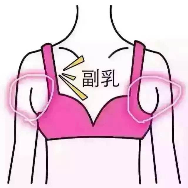 副乳越来越大应该怎么办