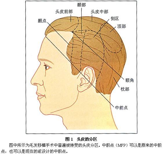 美莱医院做毛发种植是不是正规的