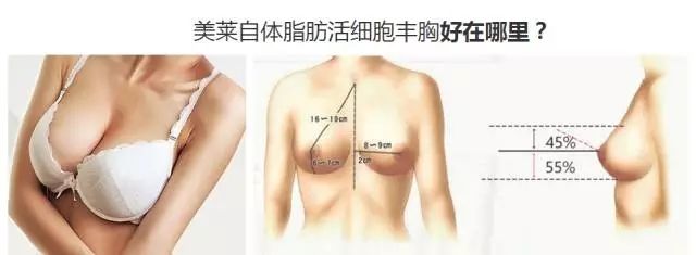 美莱自体脂肪丰胸手术费用一般要多少钱