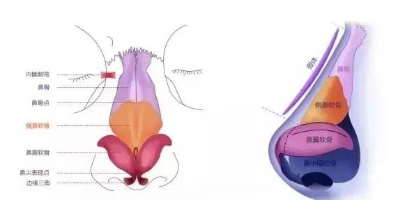 美莱医生科普:假体隆鼻与综合隆鼻有区别吗