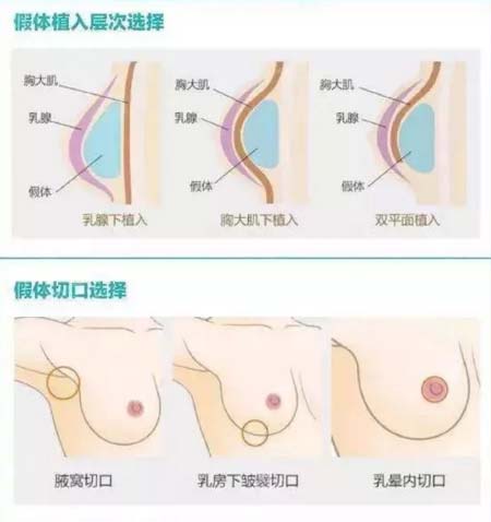 美莱6月艺术面雕节|6大爆款及预约礼、到院礼、消费礼等送不停