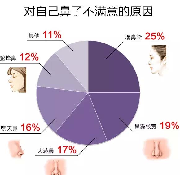 自体软骨隆鼻整形医生亲诊上海美莱