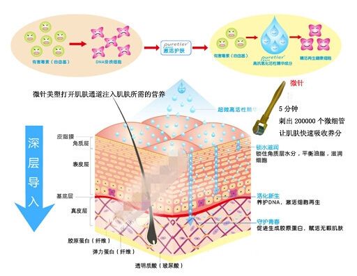 美莱微针做一次多少钱