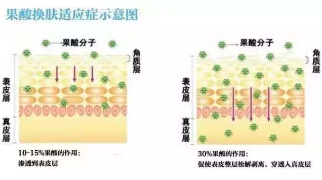 上海去哪做焕肤好