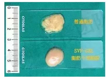 7月7日哈佛大学医学博士鲁峰携SVF-gel专利技术落户上海美莱