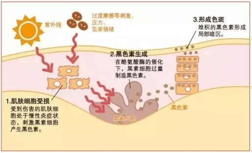 告别“斑”女郎，洁白无瑕女神脸轻松拥有！