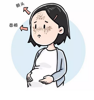 专家坐诊 | 7月20-21日，皮肤专家亲诊上海美莱