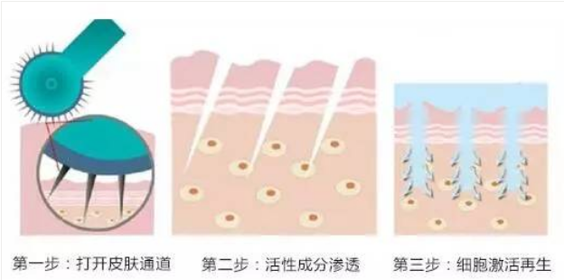 这个产品竟然能祛痘、能美白、还补水！
