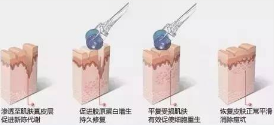这个产品竟然能祛痘、能美白、还补水！