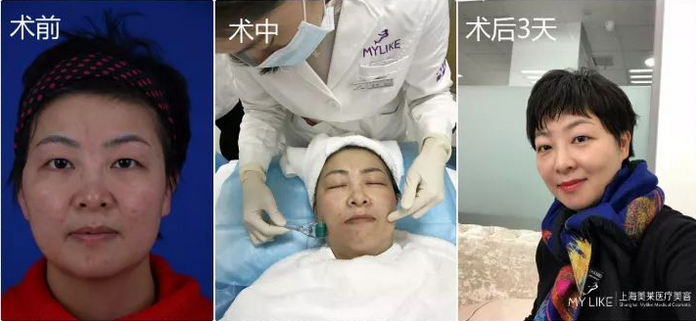 <a href='/' target='_blank'><u>上海美莱</u></a>案例