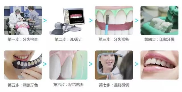 上海美莱-打造专属您的美牙！
