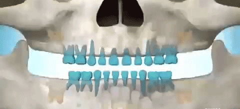 上海美莱牙齿新技术，远离药神-从齿开始！