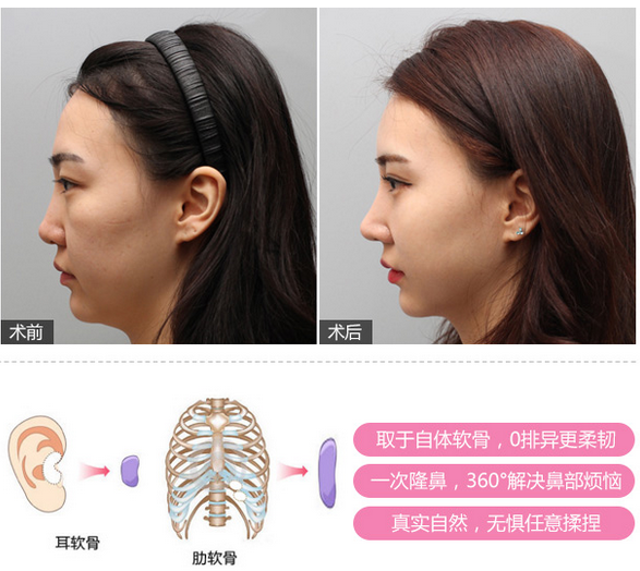 上海美莱案例