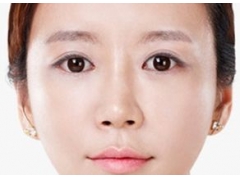 开眼角会不会疼,恢复要多久