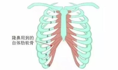 打消你对肋软骨隆鼻的后顾之忧